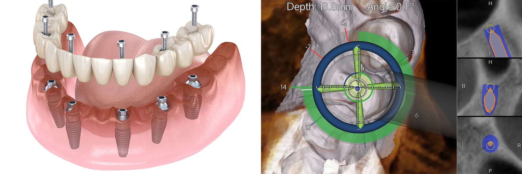 DENTISTERIE GÉNÉRALE, URGENCES DENTAIRES