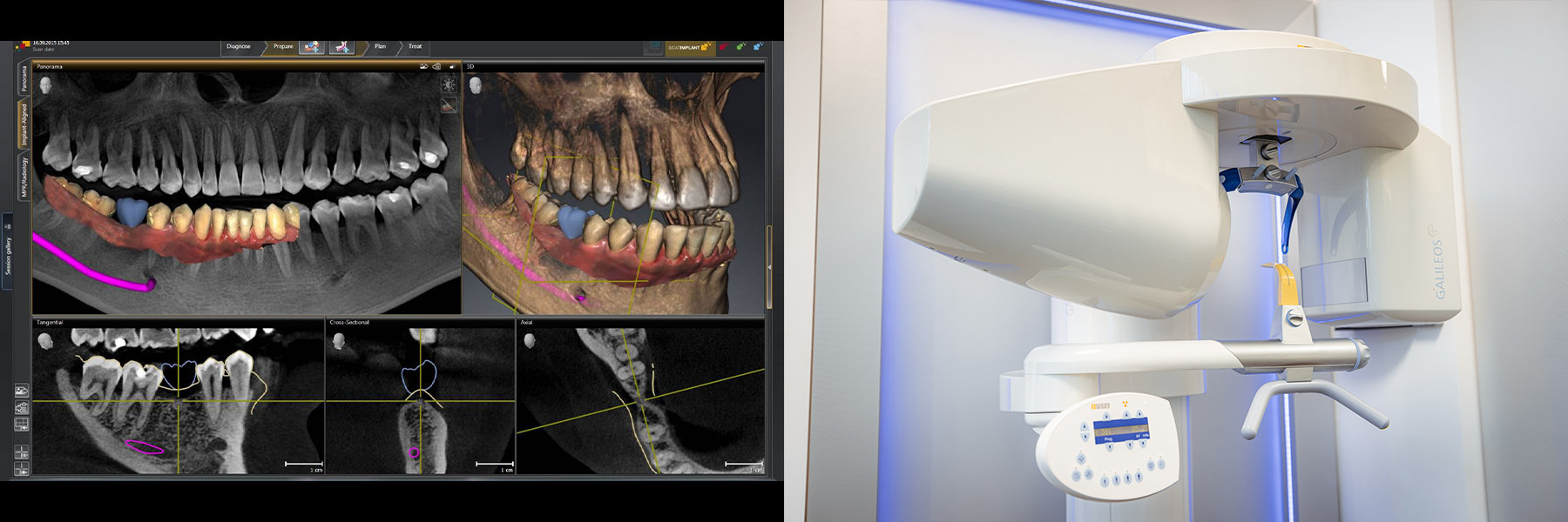 REALITE AUGMENTEE, IMPRESSION 3D, MICROSCOPE OPTIQUE